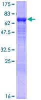 SDS-PAGE - Recombinant Human KPNA4 protein (AB114626)