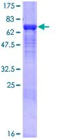 SDS-PAGE - Recombinant Human KPNA4 protein (AB114626)