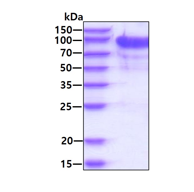 SDS-PAGE - Recombinant Human KPNB1 protein (His tag N-Terminus) (AB116172)