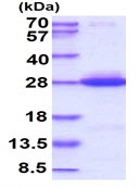 Recombinant Human KRAS (mutated Q61H) protein