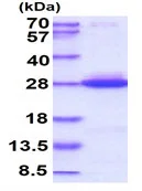 SDS-PAGE - Recombinant Human KRAS (mutated Q61H) protein (AB96817)