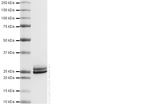 SDS-PAGE - Recombinant human KRAS Protein (His-tag) (AB309960), expandable thumbnail