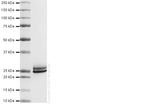 SDS-PAGE - Recombinant human KRAS Protein (His-tag) (AB309960)