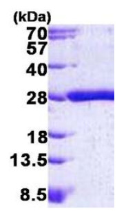 SDS-PAGE - Recombinant Human KRAS protein (His tag N-Terminus) (AB156968)