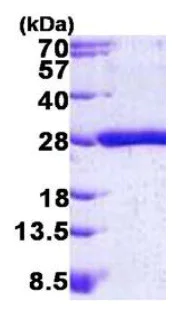 SDS-PAGE - Recombinant Human KRAS protein (His tag N-Terminus) (AB156968)