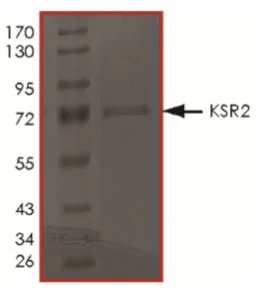 SDS-PAGE - Recombinant Human KSR2 protein (Tagged) (AB268720)