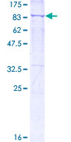 SDS-PAGE - Recombinant Human Ku70 protein (AB132938), expandable thumbnail