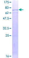SDS-PAGE - Recombinant Human kynurenine 3-monooxygenase protein (AB152891), expandable thumbnail