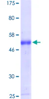 SDS-PAGE - Recombinant Human l-Myc protein (GST tag N-Terminus) (AB158935)