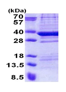 SDS-PAGE - Recombinant Human L17 protein (His tag N-Terminus) (AB171590)