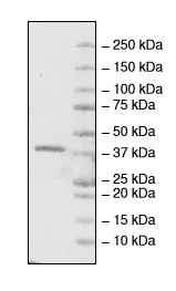 SDS-PAGE - Recombinant Human L3MBTL1 protein (His tag) (AB216180)