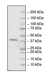 SDS-PAGE - Recombinant Human L3MBTL1 protein (His tag N-Terminus) (AB216180)