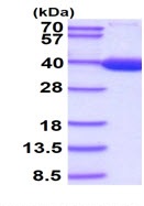 SDS-PAGE - Recombinant human Lactate Dehydrogenase B/LDH-B protein (His tag N-Terminus) (AB96765)