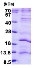 SDS-PAGE - Recombinant Human LAGE3 protein (AB156335)