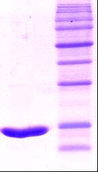 SDS-PAGE - Recombinant Human LAIR1 protein (Tag Free) (AB51219)