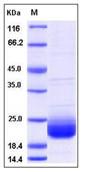 SDS-PAGE - Recombinant Human LAIR2 protein (AB276328)
