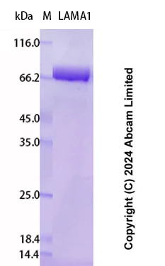 SDS-PAGE - Recombinant Human LAMA1 Protein Standard (His tag) (AB323079)