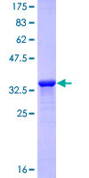SDS-PAGE - Recombinant Human LAMA3 protein (AB158810), expandable thumbnail