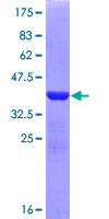 SDS-PAGE - Recombinant Human LAMB3 protein (GST tag N-Terminus) (AB158811)