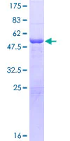SDS-PAGE - Recombinant Human Lambda Light chain protein (AB158750)