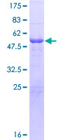 SDS-PAGE - Recombinant Human Lambda Light chain protein (GST tag N-Terminus) (AB158750)