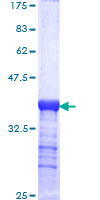 SDS-PAGE - Recombinant Human LAMC2 protein (AB158812)