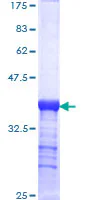 SDS-PAGE - Recombinant Human LAMC2 protein (GST tag N-Terminus) (AB158812)