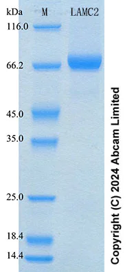 SDS-PAGE - Recombinant Human LAMC2 Protein Standard (His tag) (AB316641)
