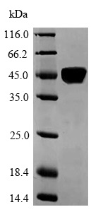 SDS-PAGE - Recombinant Human Laminin alpha 5/LAMA5 protein (Tagged) (AB235807)