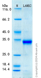 SDS-PAGE - Recombinant Human Laminin Beta 2 Protein Standard (AB316606), expandable thumbnail