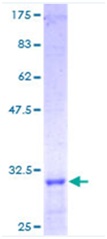 Recombinant Human Laminin gamma 1 protein