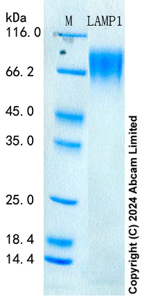 SDS-PAGE - Recombinant Human LAMP1 Protein Standard (His tag) (AB322280)