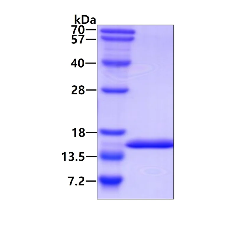 SDS-PAGE - Recombinant Human LAMTOR2 protein (AB101637)