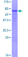 SDS-PAGE - Recombinant Human LANCL2 protein (AB163277), expandable thumbnail