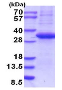 SDS-PAGE - Recombinant Human Langerin protein (denatured) (AB202625), expandable thumbnail