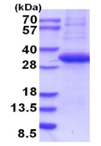 SDS-PAGE - Recombinant Human Langerin protein (denatured) (His tag N-Terminus) (AB202625)