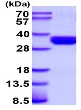 SDS-PAGE - Recombinant Human Langerin protein (His tag) (AB219216), expandable thumbnail
