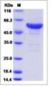 SDS-PAGE - Recombinant Human LAP3 protein (His tag) (AB276661)