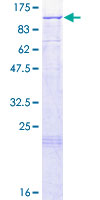 SDS-PAGE - Recombinant Human LARS2 protein (AB161621), expandable thumbnail