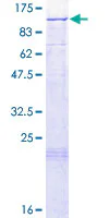SDS-PAGE - Recombinant Human LARS2 protein (GST tag N-Terminus) (AB161621)