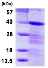 Recombinant Human LASP1 protein