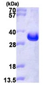 SDS-PAGE - Recombinant Human LAT protein (His tag N-Terminus) (AB113124)