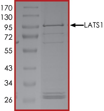 Recombinant human LATS1/WARTS protein