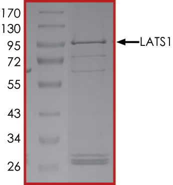 SDS-PAGE - Recombinant human LATS1/WARTS protein (AB125612)
