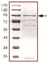 SDS-PAGE - Recombinant human LATS1/WARTS protein (AB125612)