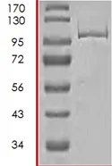 SDS-PAGE - Recombinant Human LATS2 protein (AB71357)