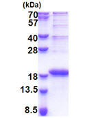 SDS-PAGE - Recombinant Human LBH protein (AB171498), expandable thumbnail