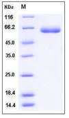 SDS-PAGE - Recombinant Human LBP protein (His tag) (AB276289)