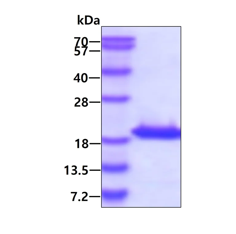SDS-PAGE - Recombinant Human LC3B protein (His tag N-Terminus) (AB103506)