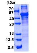 SDS-PAGE - Recombinant Human LCAT protein (denatured) (AB139631)